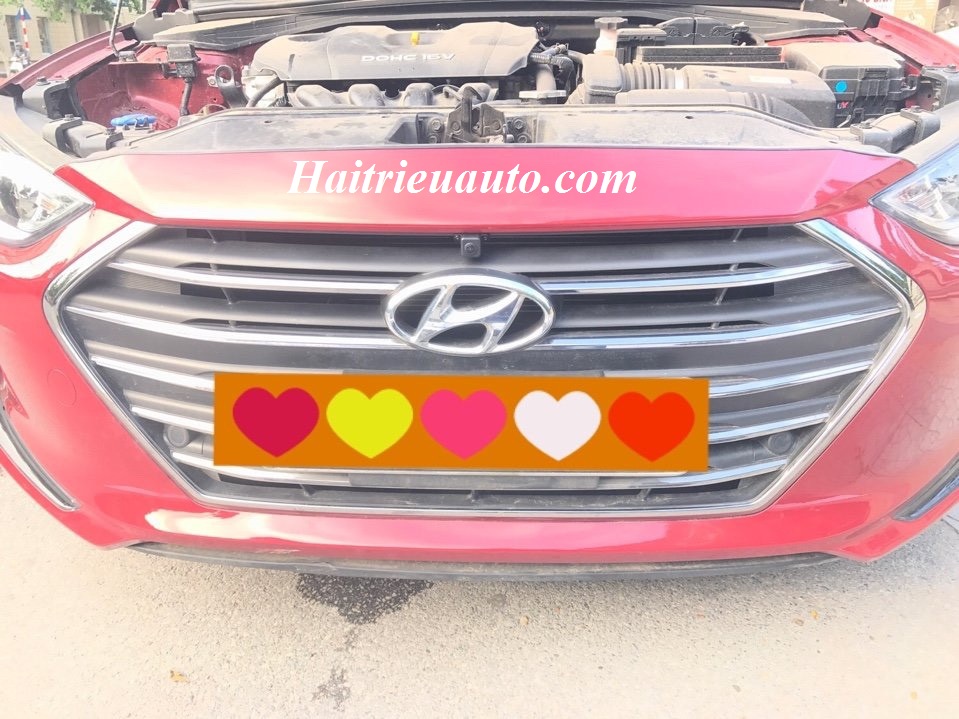 Camera 360 cho xe Hyundai Elantra 6 Image